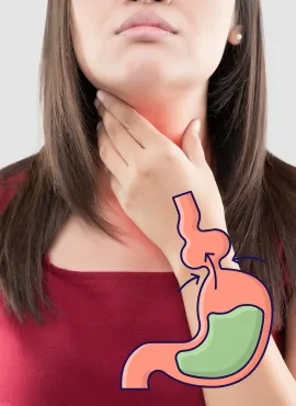Cirugía de Hernia Hiatal en Tepic